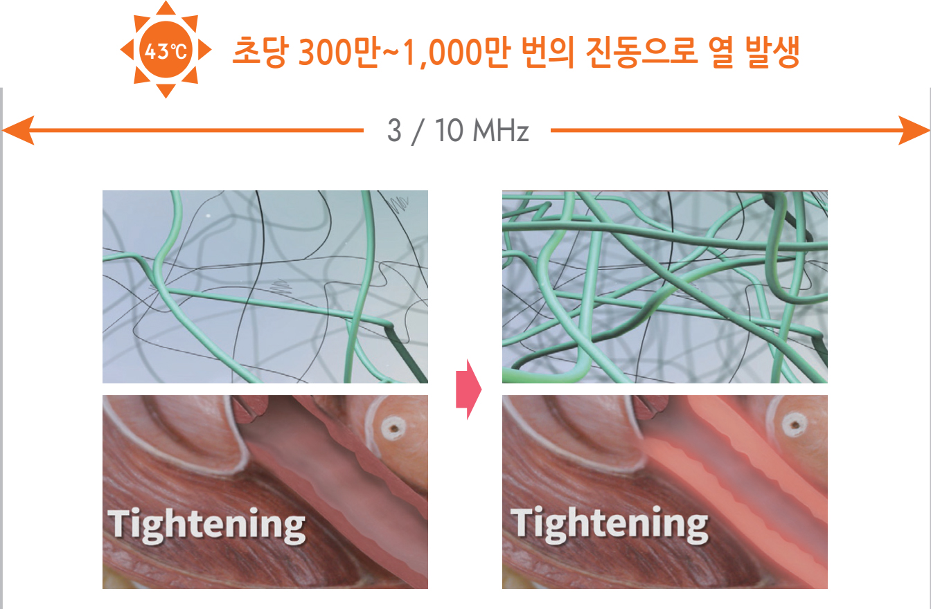 초당 300만~1,000만 번의진동으로 열 발생