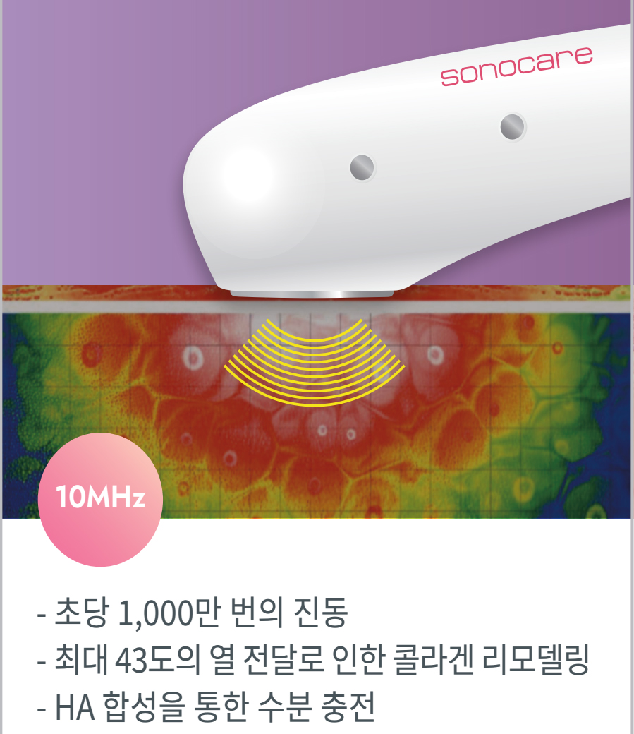 초당 1,000만 번의진동 최대 43도의 열 전달로 인한 콜라겐 리모델링 HA 합성을 통한 수분 충전