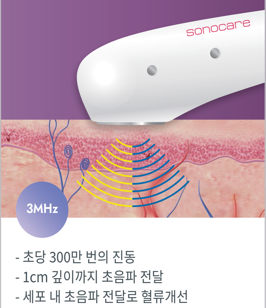초당 300만 번의진동 1cm 깊이까지 초음파 전달 세포내 초음파 전달로 혈류 개선